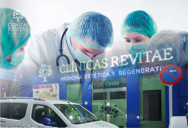 Clínica Revitae oferta tratamiento pionero de implante capilar de alta durabilidad